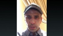Henrique Capriles descartó padecer cáncer de piel tras evalu...