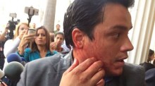 Agredido el diputados de Primero Justicia Carlos Paparoni en...