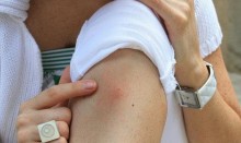 Salud Miranda alerta que mujeres son más propensas al Zika 